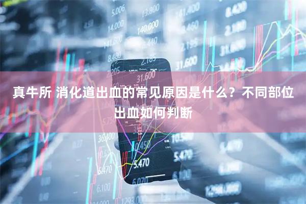 真牛所 消化道出血的常见原因是什么？不同部位出血如何判断